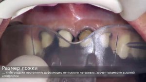 Одномоментный оттиск из А-силиконов