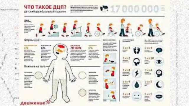 ДЦП  не приговор.  Он  успешно лечится.