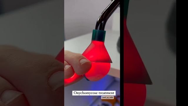 Работа с грибковой инфекцией #shorts смотреть онлайн