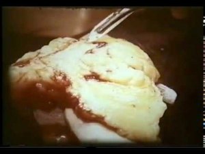 Липома, опухоль молочной железы - срочная биопсия © lipoma, rush biopsy, Academician V.Paukov