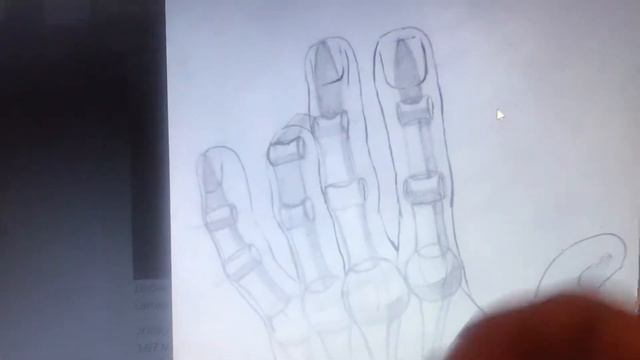 Частые ошибки. Кисть Апполона смотреть онлайн