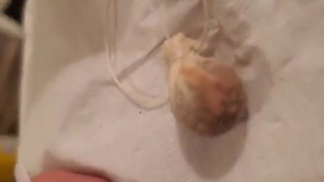 Yoni Pearl Results | Very DETAILED and GRAPHIC смотреть онлайн