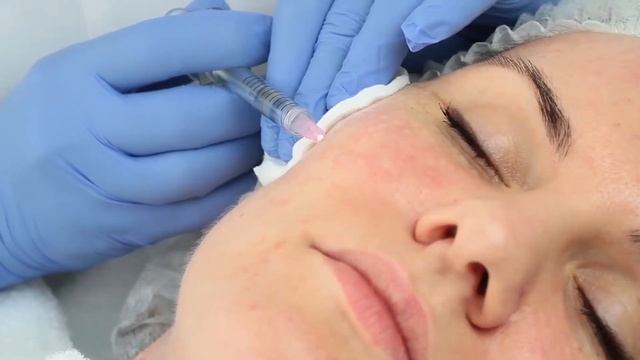 Клиника эстетической медицины и косметологии в Ялте | Skin Architect смотреть онлайн