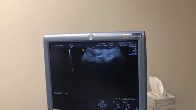 FIRST ULTRASOUND and it’s HOW MANY? смотреть онлайн