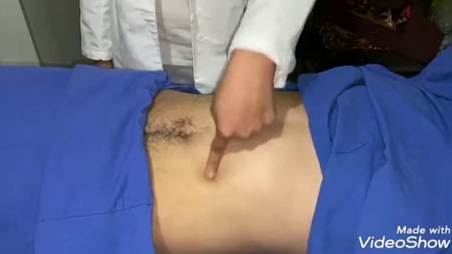 Signo de Fovea/Godet смотреть онлайн