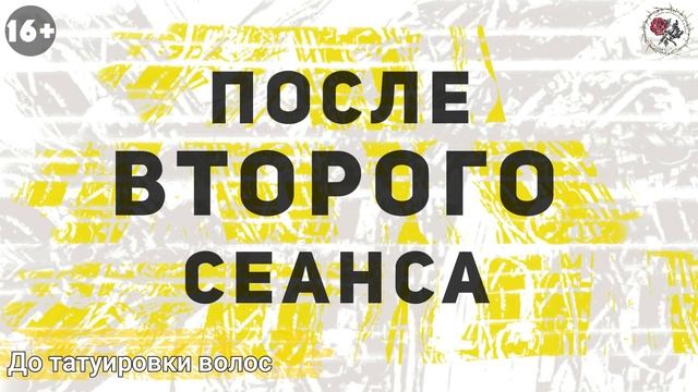 Трихопигментация, татуировка головы после системы волос. Scalp micropigmentation by Andrey Afanasev смотреть онлайн