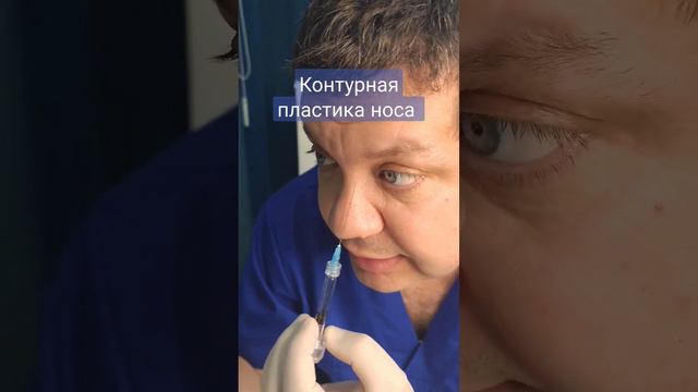 Как убрать горбинку носа? смотреть онлайн