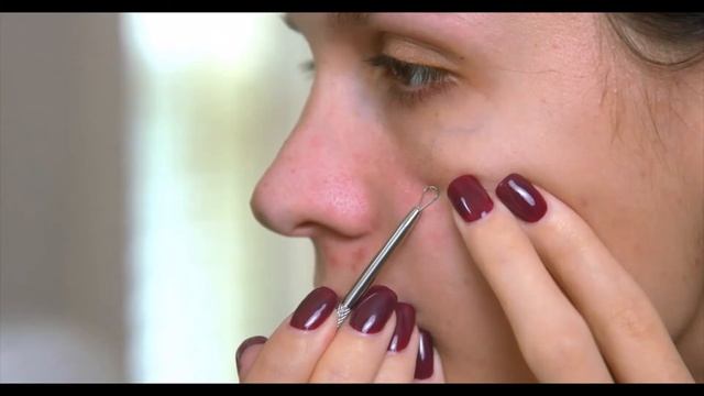 acne extractor смотреть онлайн