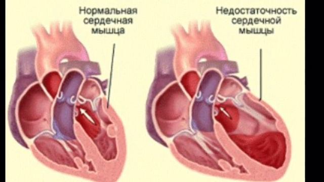 Склероз Смотреть всем ! Срочно ! Доверяй Но проверяй. смотреть онлайн