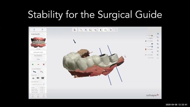 Tips and Tricks with 3Shape's Implant Studio_04092020 смотреть онлайн
