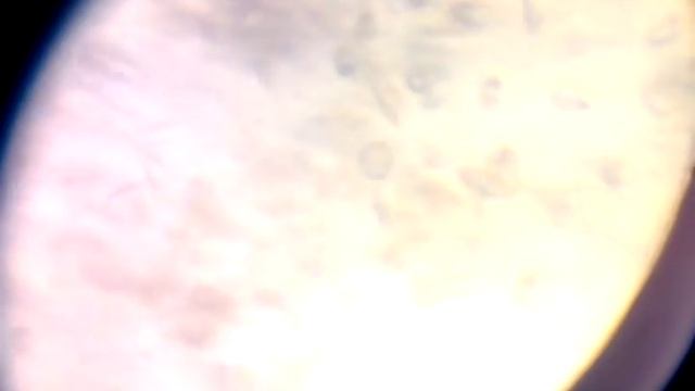 Бактерии и действие йода на них/ effect of iodine on the bacteria смотреть онлайн