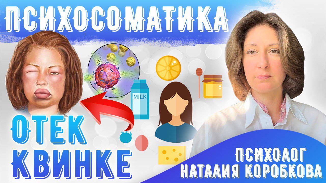 Отек Квинке психосоматика смотреть онлайн