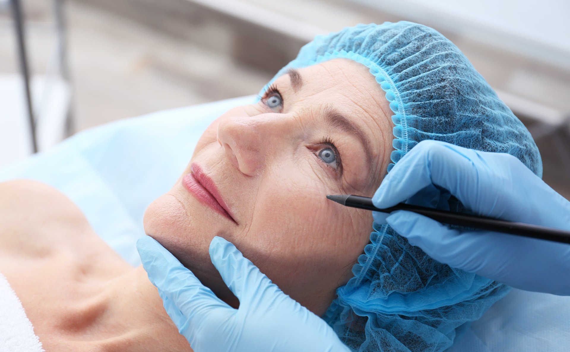 Блефаропластика.