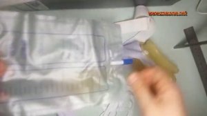 Мочеприемник носимый многоразового использования мужской женский, Мочевой катетер, Обзор товаров