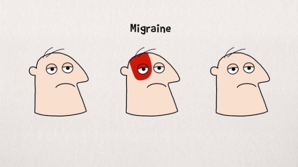 What causes headaches? - Dan Kwartler