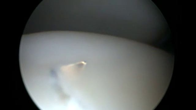 Игла в хряще. Ужас собачьего артроскописта смотреть онлайн