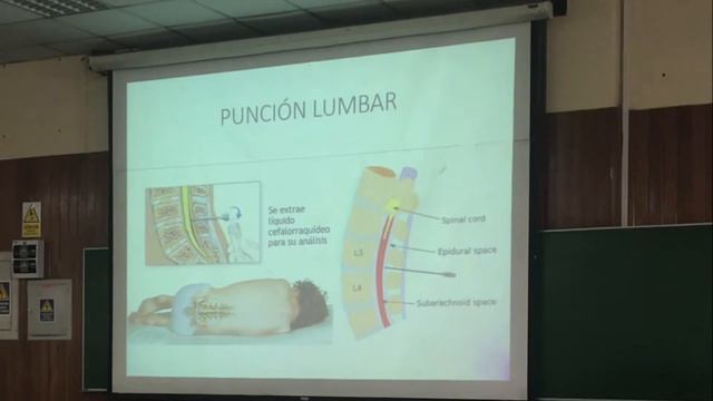 Neuro 6 смотреть онлайн