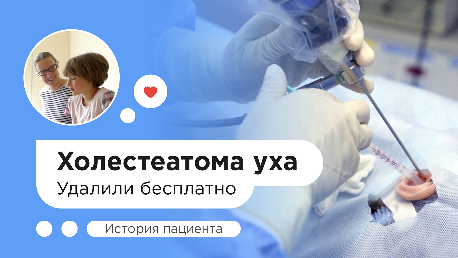 Удаление холестеатомы уха бесплатно по ОМС смотреть онлайн