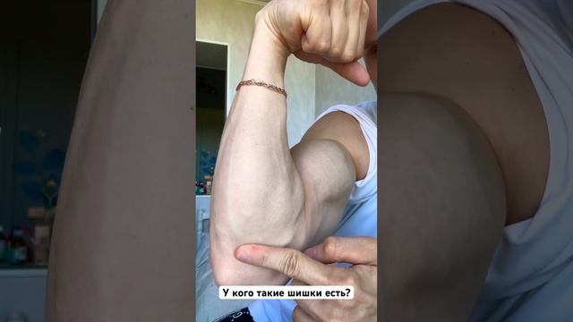 У кого такие шишки есть? смотреть онлайн