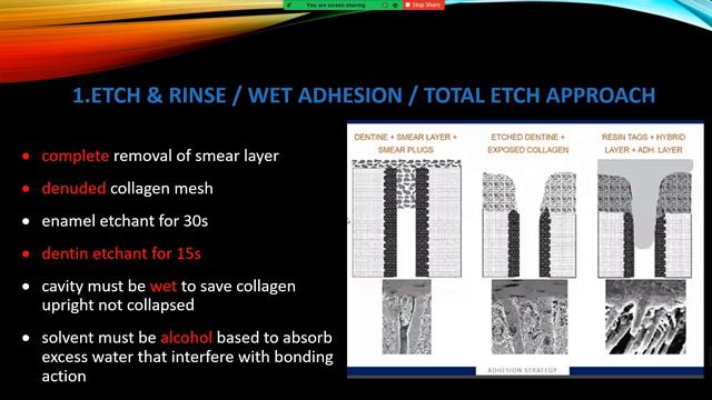 Post Operative Sensitivity & Introduction To Bonding || Dr. Mostafa Zordok
