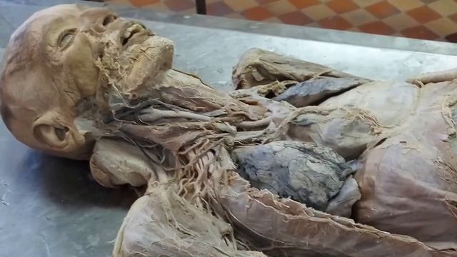 Анатомия. Сосудисто-нервный пучок шеи