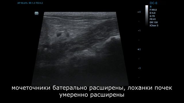 Опухоль мочевого пузыря у кошки смотреть онлайн