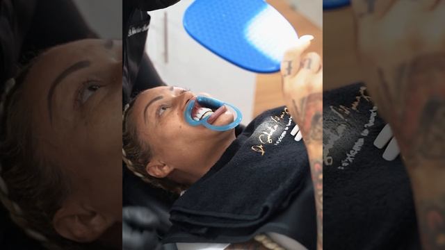 PORCELAIN SMILE DESIGN / Odontólogo Sebastian Manzano смотреть онлайн