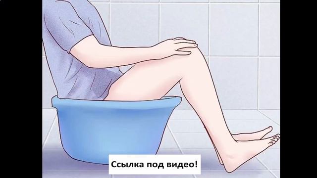 геморрой рыбинск смотреть онлайн