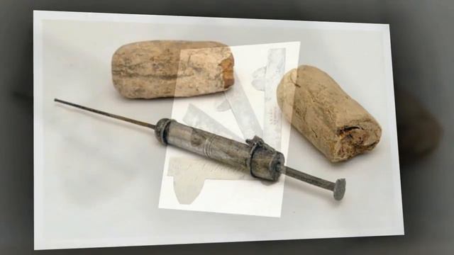 УЖАСНЫЕ МЕДИЦИНСКИЕ ИНСТРУМЕНТЫ ПРОШЛОГО смотреть онлайн