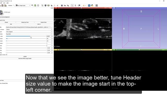 How to load a file of unknown format into 3D Slicer смотреть онлайн