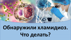 Обнаружили хламидиоз. Что делать?