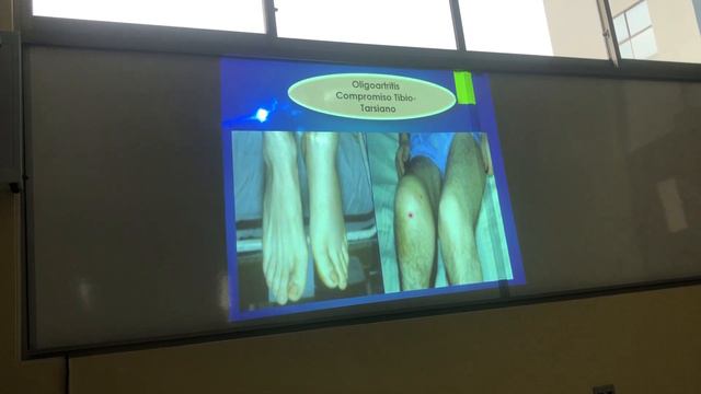 Clase 6 part 2 - Reumatologia 3ra parcial - Dra Felicidad смотреть онлайн