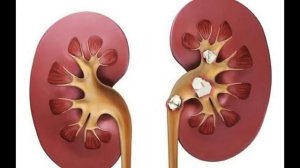 Дистиллированная вода. Польза или вред.