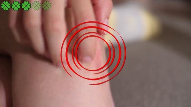 Укусы насекомых! Эти 5 укусов насекомых, нужно знать. | Я знаю смотреть онлайн