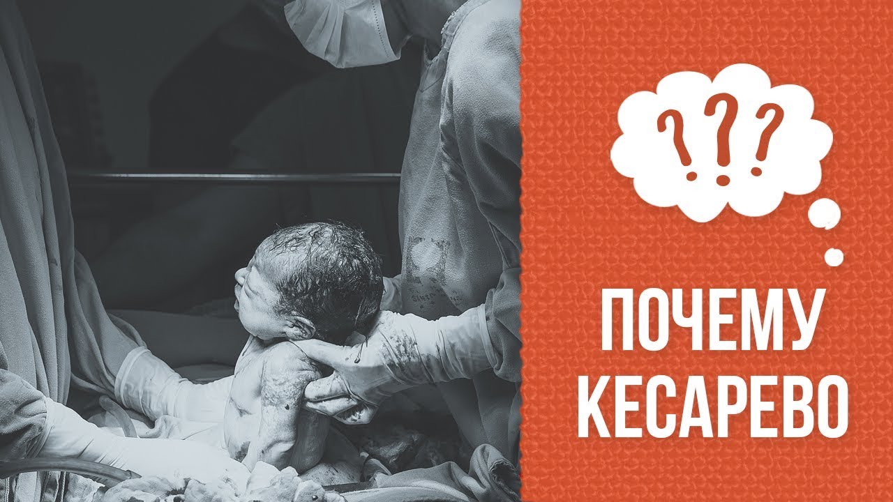 Почему кесарево сечение? смотреть онлайн