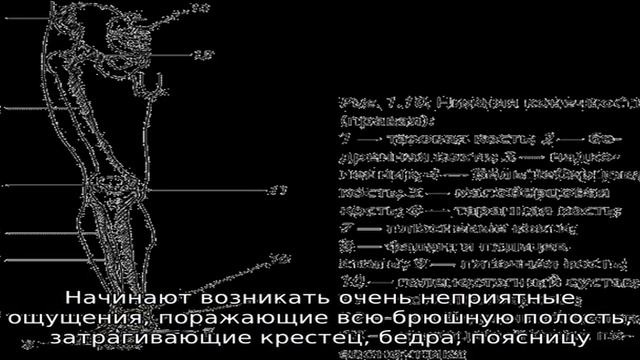 Боль в крестце, отдающая в ногу смотреть онлайн