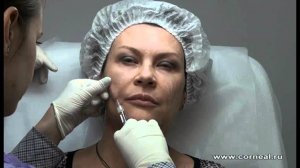 Учимся работать канюлей