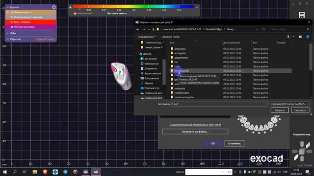 sdfa to stl Exocad3 смотреть онлайн