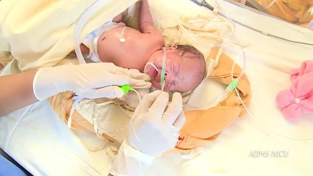 How to monitor a newborn baby receiving oxygen therapy? смотреть онлайн