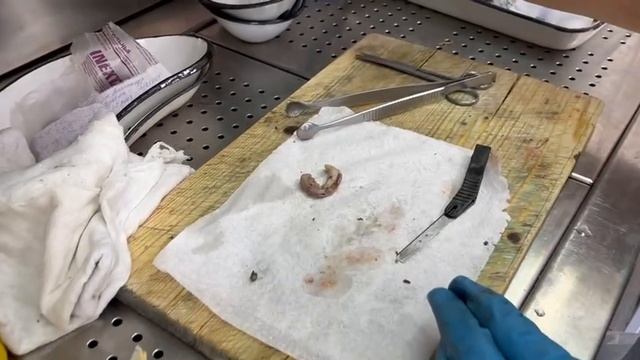 Находка в аппендиксе смотреть онлайн