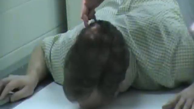 Adult Orbit and Foramen-AP&PA (R and L) ParietoOrbital Oblique смотреть онлайн