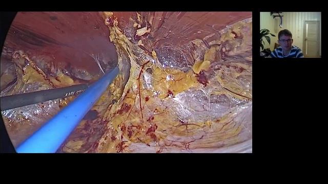 еТЕР RS, Ахметов Азат смотреть онлайн