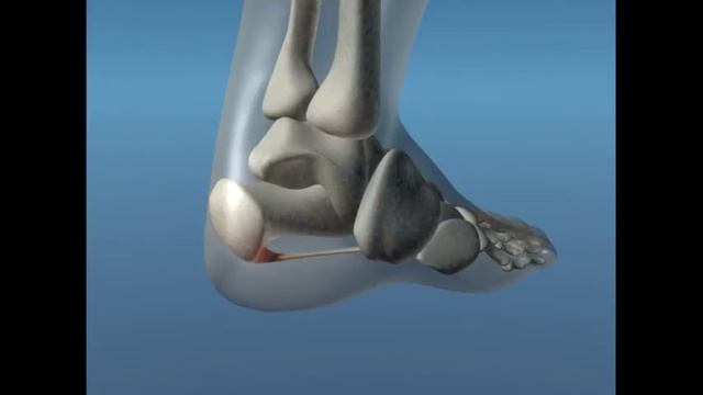 NarmedTV: Артрит и пяточная шпора смотреть онлайн