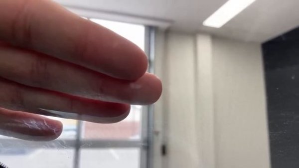 LIVE: 2023 Kia Sportage X-Line vs Sportage X-Line Limited. - Green Interior shown - (it looks grey!