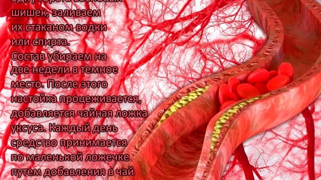 5 Самых эффективных способов для Чистки сосудов смотреть онлайн