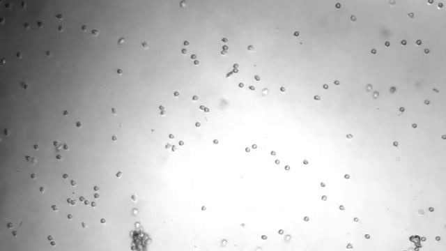 Chemoattractant: 0.1 ng/ml CXCL5 смотреть онлайн