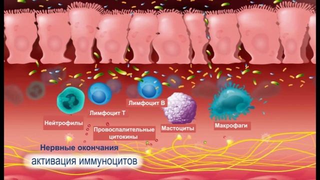 Синдром подразненого кишківника. Метеоспазміл смотреть онлайн