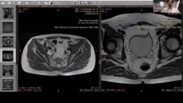 DKT GIT abdomen and pelvis || genitourinary system (part2) || Dr khan teaching session смотреть онлайн