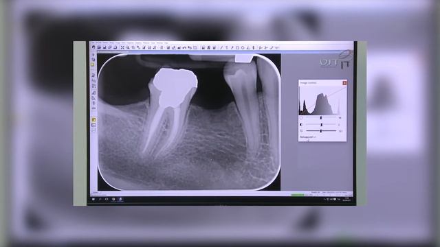 KaVo Scan eXam One - сканер фосфорных пластин | KaVo (Германия) смотреть онлайн