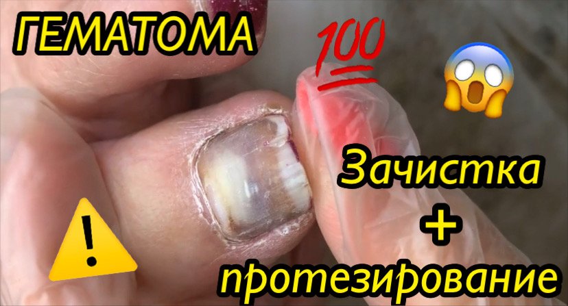 IMG_3982.MOV смотреть онлайн